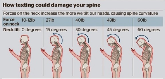 Is staring at your smartphone hurting your back